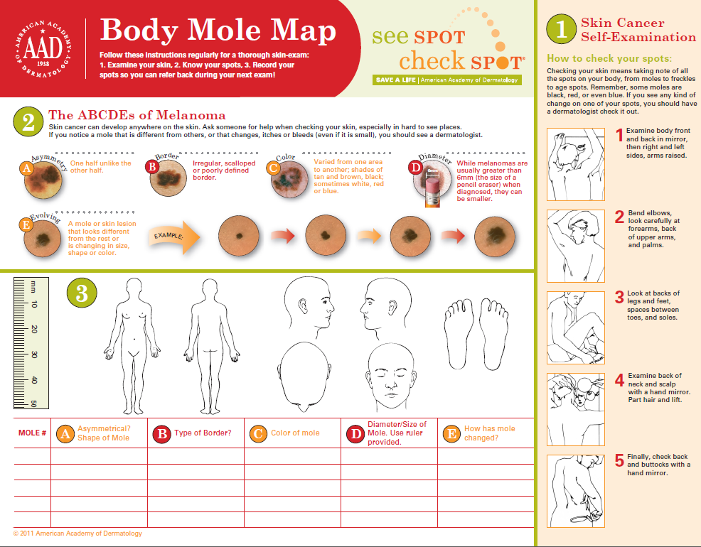 Body Map - American Academy of Dermatology